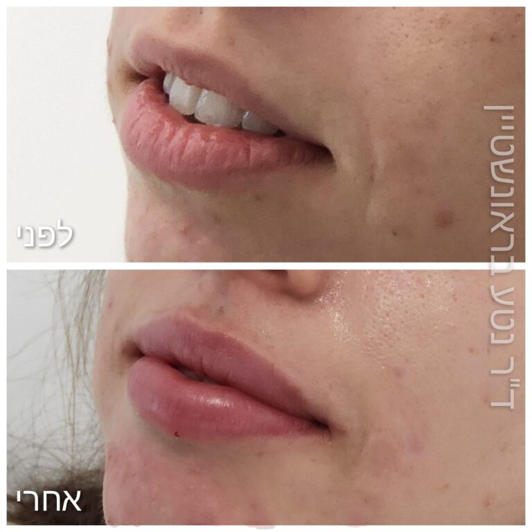 עיצוב שפתיים
